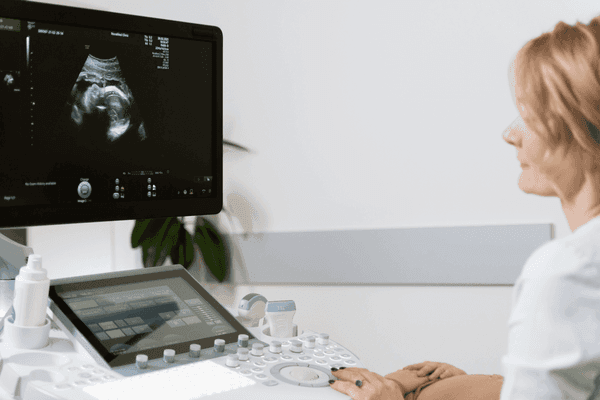 Using ultrasound to image fetus